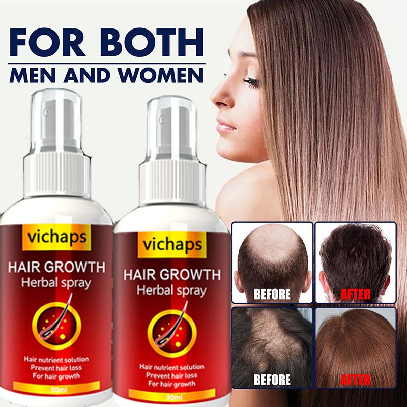 Hair Growth Serum Spray Fast Hair Growth Liquid Treatment Scalp Hair