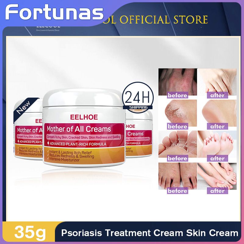 30g 50g Eczema Cream Anti-itching Cream Skin External Skin Repair Cream 