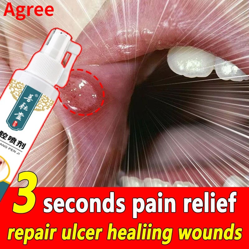 Canker sore spray 50ml mouth ulcer treatment Canker mouth sore solution