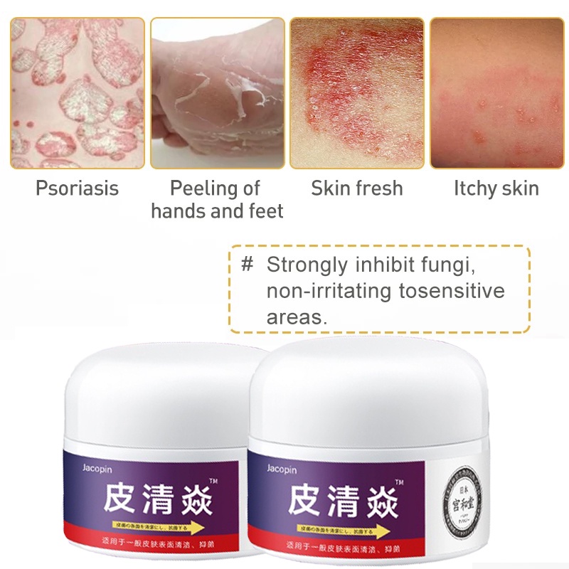 Skin Psoriasis Eczma Cream for All Kinds of Skin Problems Chinese ...