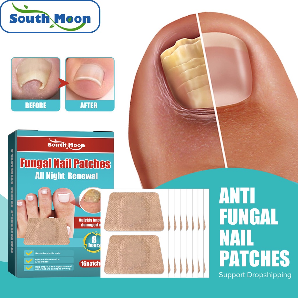 South Moon Nail Treatment Patch Anti Fungal Nail Correction Stickers ...