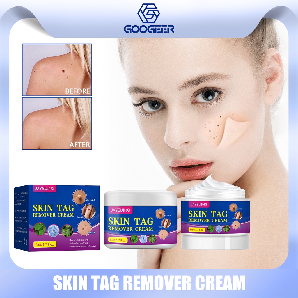 Jaysuing Skin Tag Remover Cream Painless Mole Skin Dark Spot Warts