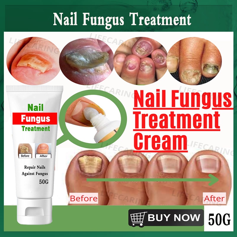 50g Nail repair Cream Quick Repair DamagedNourishing nails, anti
