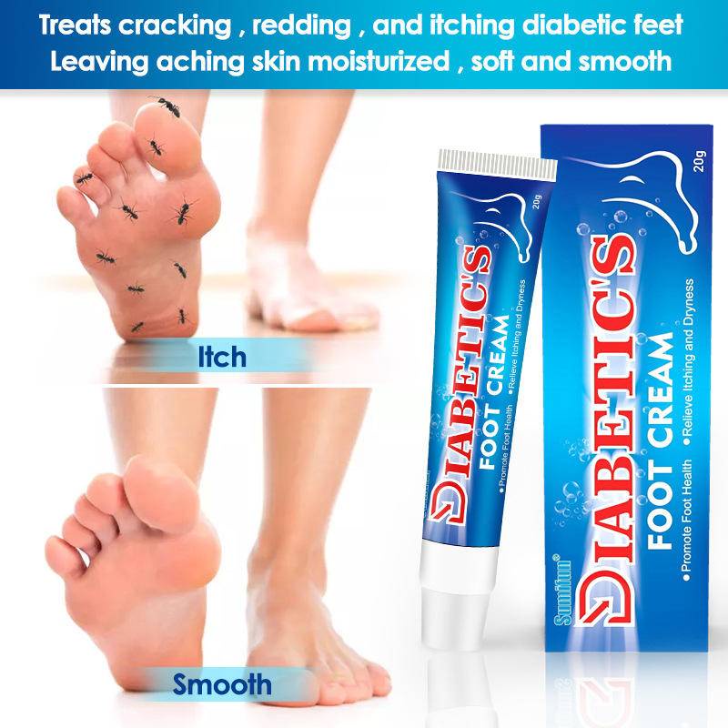Sumifun Diabetic's Foot Cream Itchy Foot Care Ointment Improve Skin ...