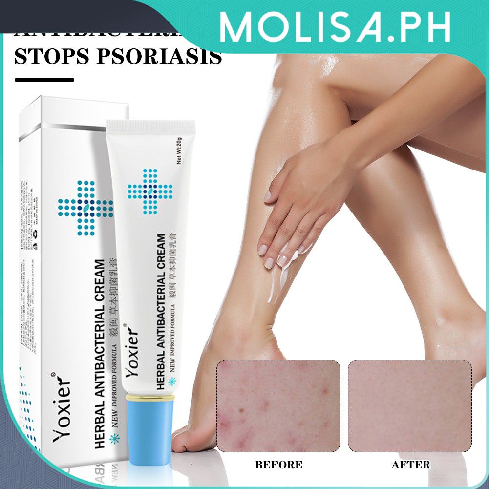Yoxier Herbal Antibacterial Cream Psoriasis Cream Itchy Skin Relieve