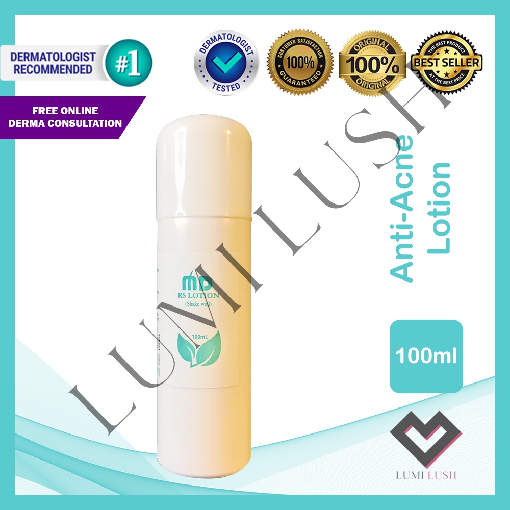 R & S AntiAcne Lotion 100ml Resorcinol + Sulfur Anti Acne Oil control