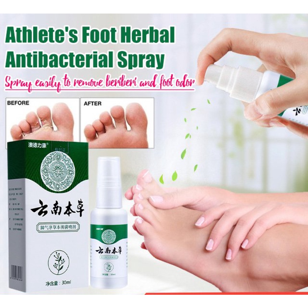 Athlete's foot treatment herbal antibacterial spray Shopee Philippines