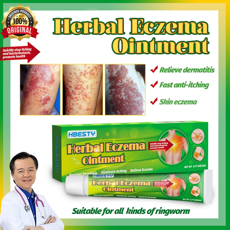 atoderma cream anti fungal cream eczema psoriasis cream ointment eczema ...