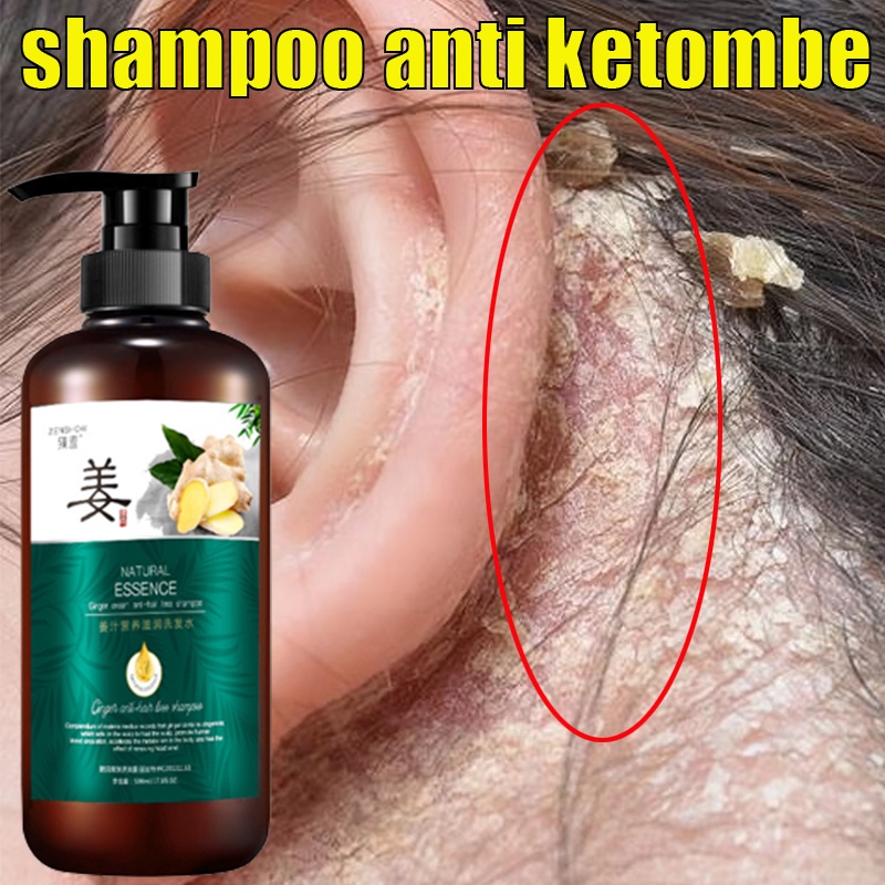 Antidandruff head lice Shampoo Anti Hair Loss Hair Growth Mite Removal