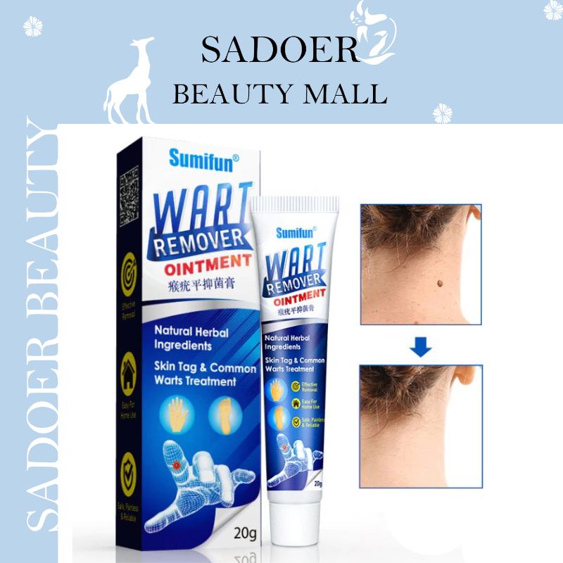 SADOER Warts Remover Cream Foot Corns Removal To Remove Calluses On The Feet Body Skin Tags Mole