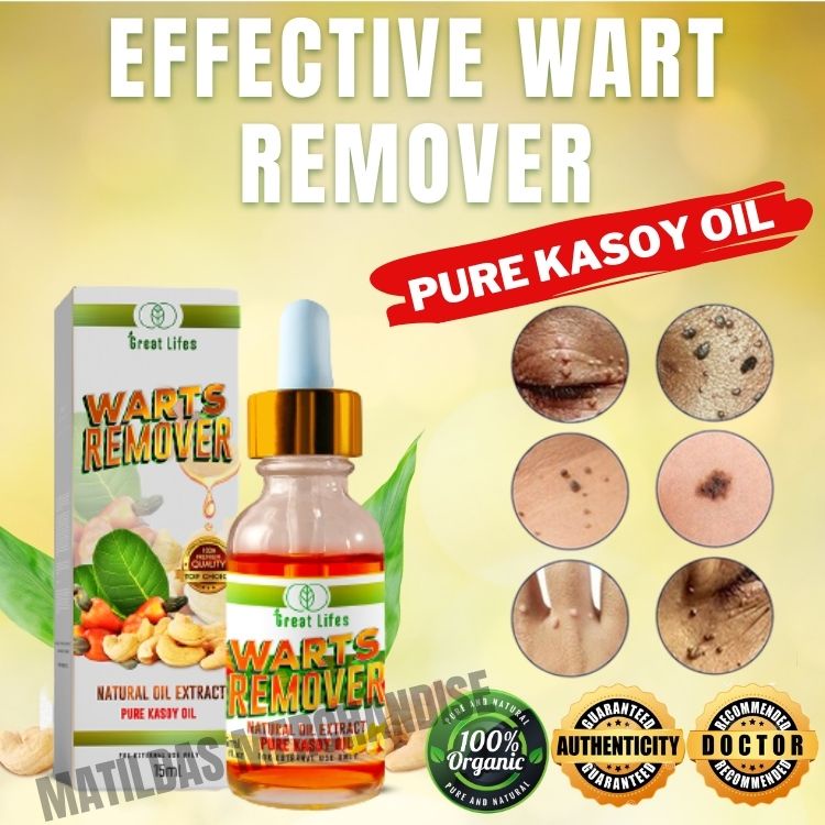 Warts Remover Pure Kasoy Oil Skin Tag Remover Originals Warts Cream ...