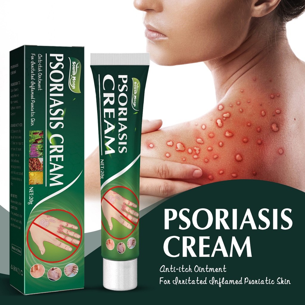 Aca 20g Psoriasis Cream Deep Penetration External Use Anti Itch Antipruritic Effective