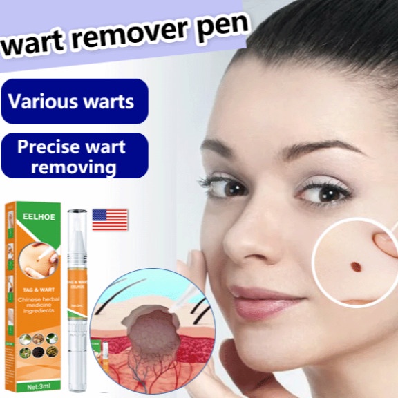 【Buy1 Free1】Eelhoe wart remover repairing solution pen,Wart Remover