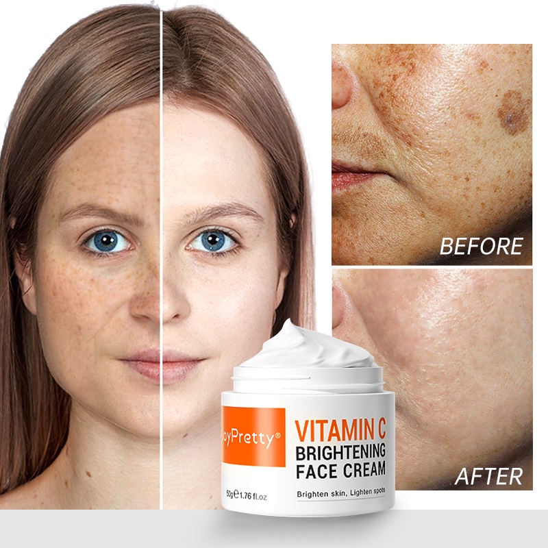 JoyPretty VC Face Whitening Cream Skin Care Dark Spots Removal Freckles