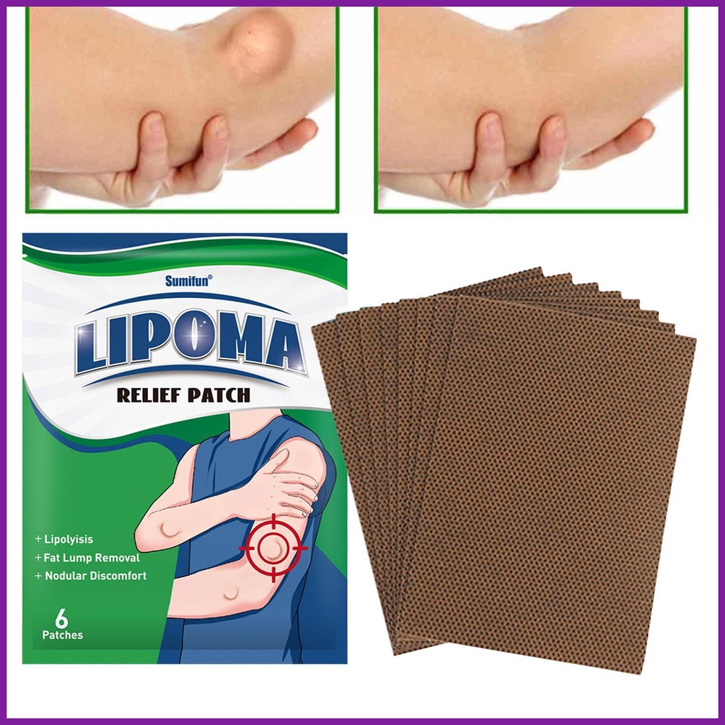 Lipoma Removal Patch 6pcs Anti-Swelling Lipoma Removal Patch with ...