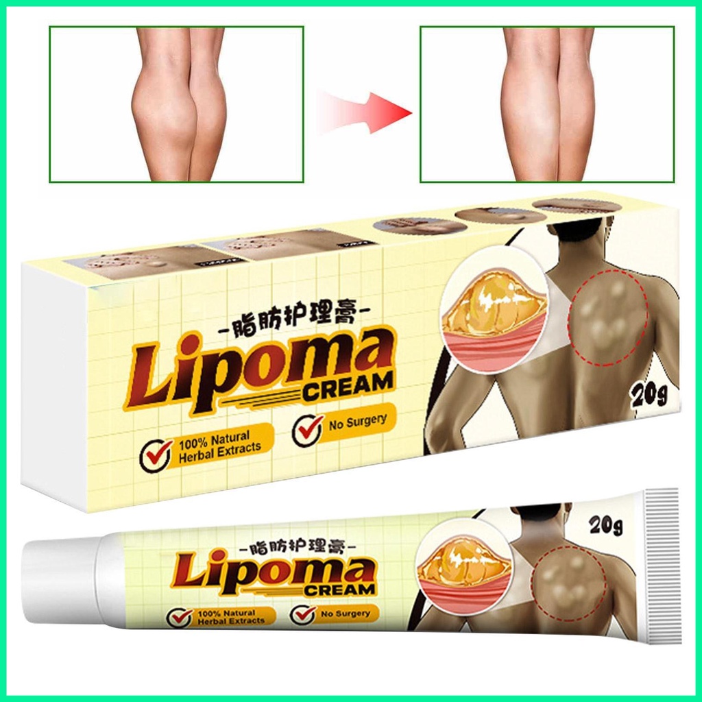 Lipoma Removal Cream Natural Herbal Fat Lumps Removal Ointment Easy To Absorb Lipoma Lumps 