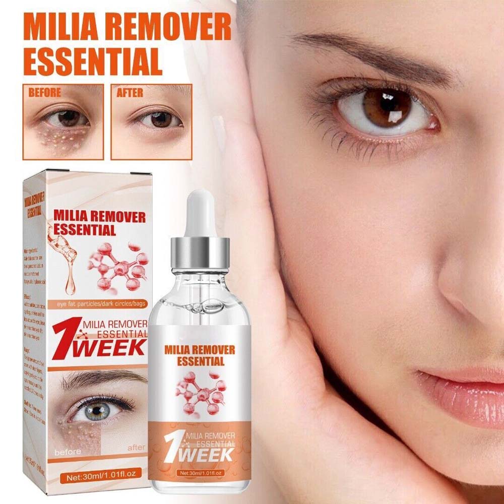 Eye Milia Removal Cream Mild Milia Remover Essential For Women Milia