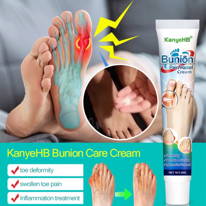 KanyeHB Bunion Pain Relief Cream Shopee Philippines