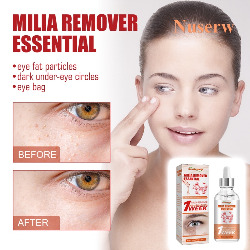 Nuserw 30ML DermaPRO Quick Milia Remover, Milia Face Serum Lifting
