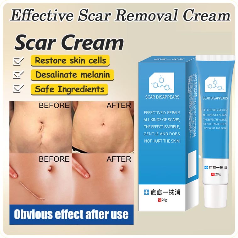 scar remover for old scar on leg Old Scar Scar Remover Cream Remove