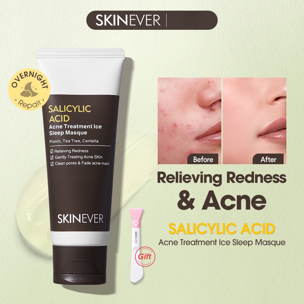 SKINEVER Salicylic Acid Acne Treatment Ice Sleep Masque Acne Relief