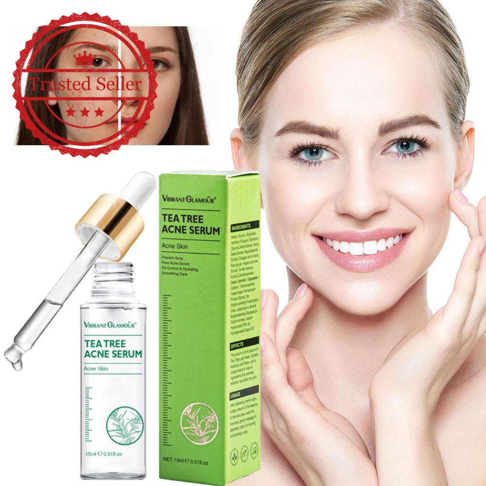 VIBRANT GLAMOUR Tea Tree Acne Face Serum Anti Acne Repair Pimple Marks