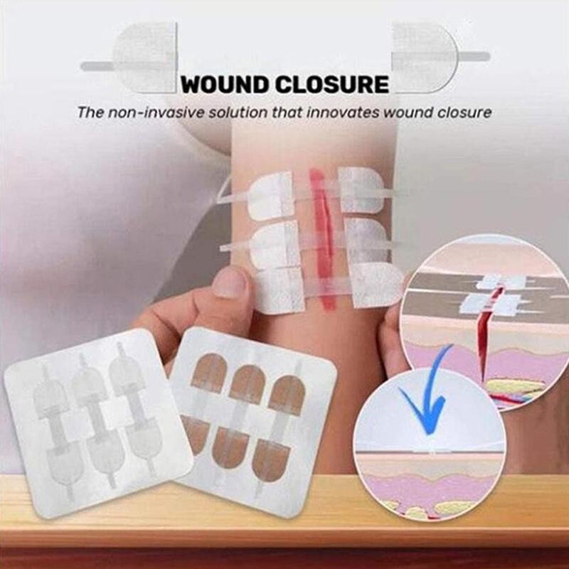 Zipper Bandaid Painless Wound Closure Device Without Needles Suturefree Wound Dressing Patch
