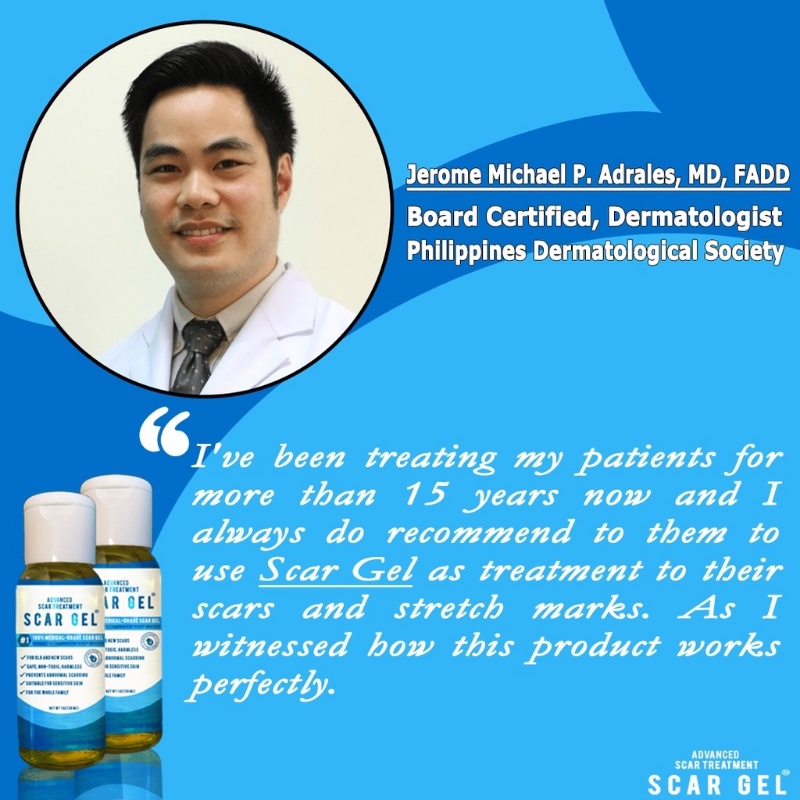 SCAR GEL By Dra. Aura Scar Treatment Stretch Marks Acne Keloids 30Ml Shopee Philippines