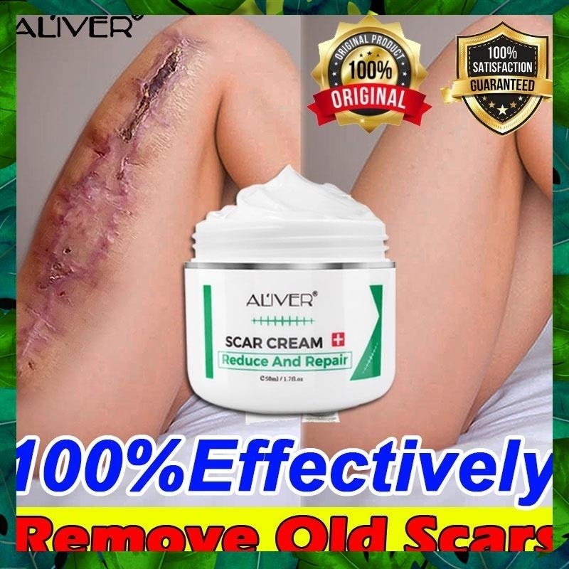 Scar Remover Peklat Scarminator Cream Strech Mark Remover Pimple for