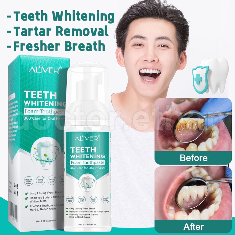 ALIVER Teeth whitening mousse tootCOD hpaste Remove Tartar Remove Plaqu
