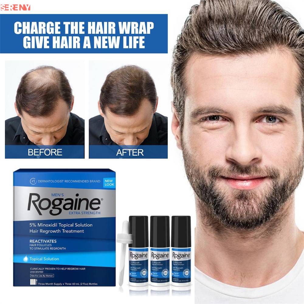 Rogaine 5% Minoxidil Solution, Men's Extra Strength 5% Minoxidil ...