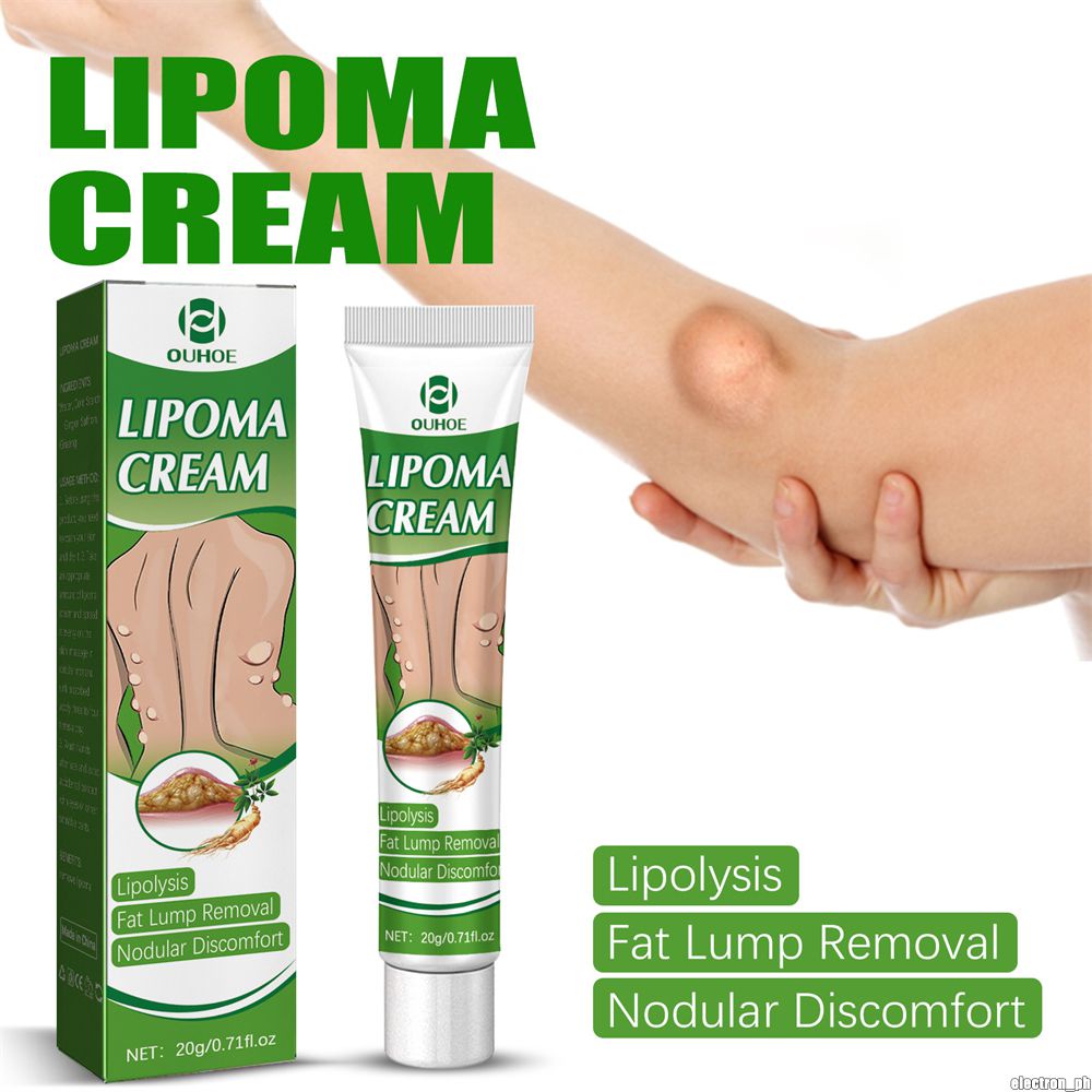 OUHOE Lipoma Removal Cream Fat Knot Repair Soothing Body Digestion ...