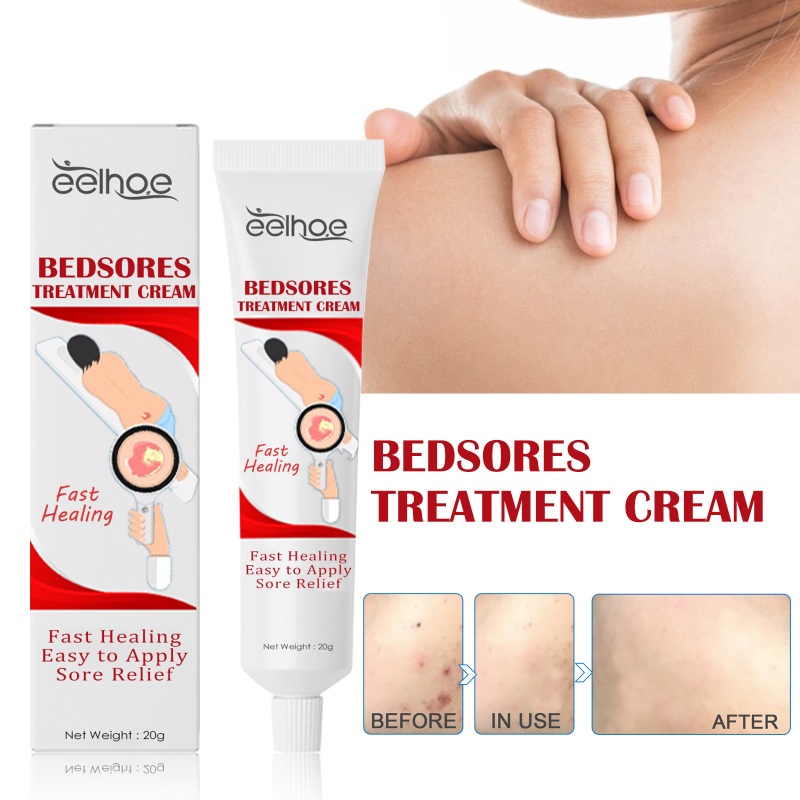 EELHOE Bedsores Wound Healing Cream Inhibit Fungal Sores Treatment Pain