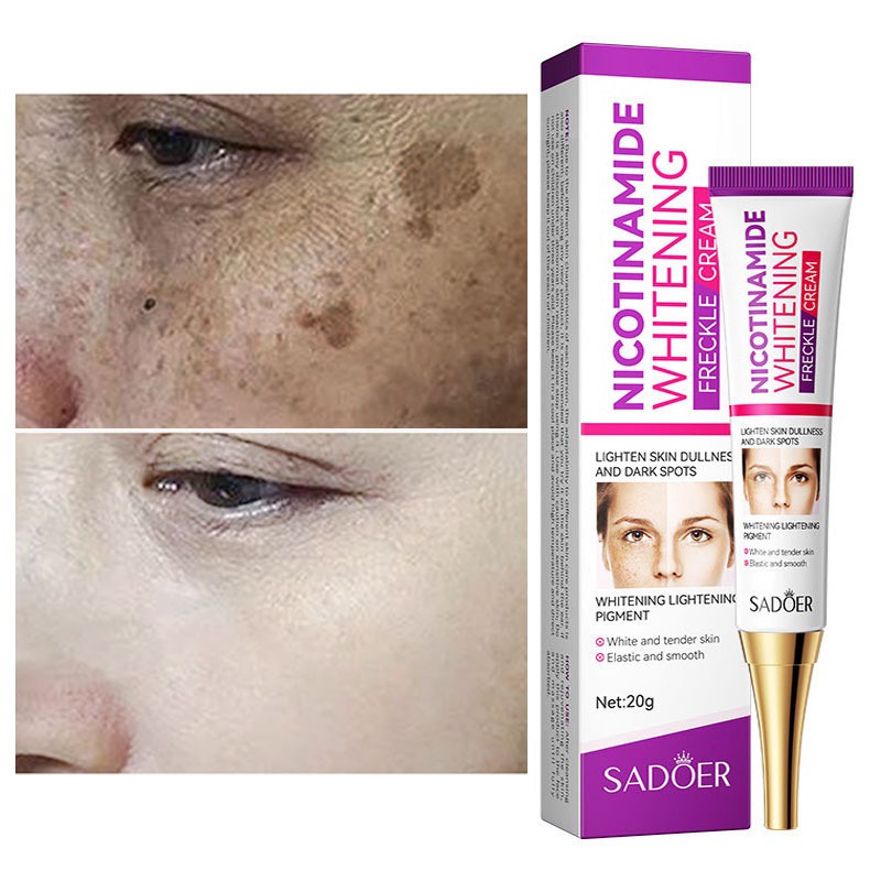 Nicotinamide Whitening Freckles Cream Remove Melasma Dark Spot Acne Marks Lightening Melanin
