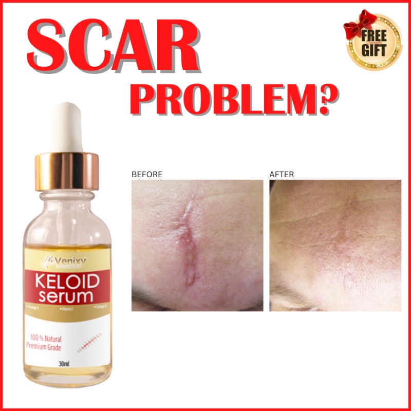 SCAR REMOVER Keloid Serum, Scar Remover Scar Original, Dr. Scar Remover Keloid, Scar Removal