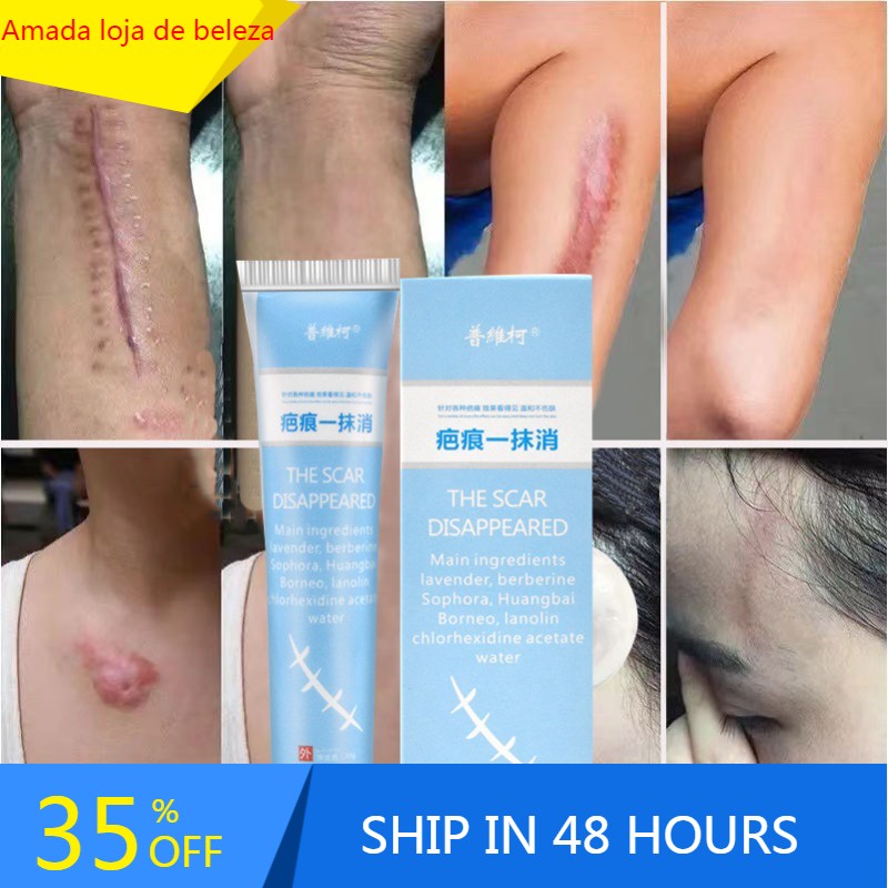 Herbal Essence Skin Scar Removal Cream For Burns Surgery Plastic