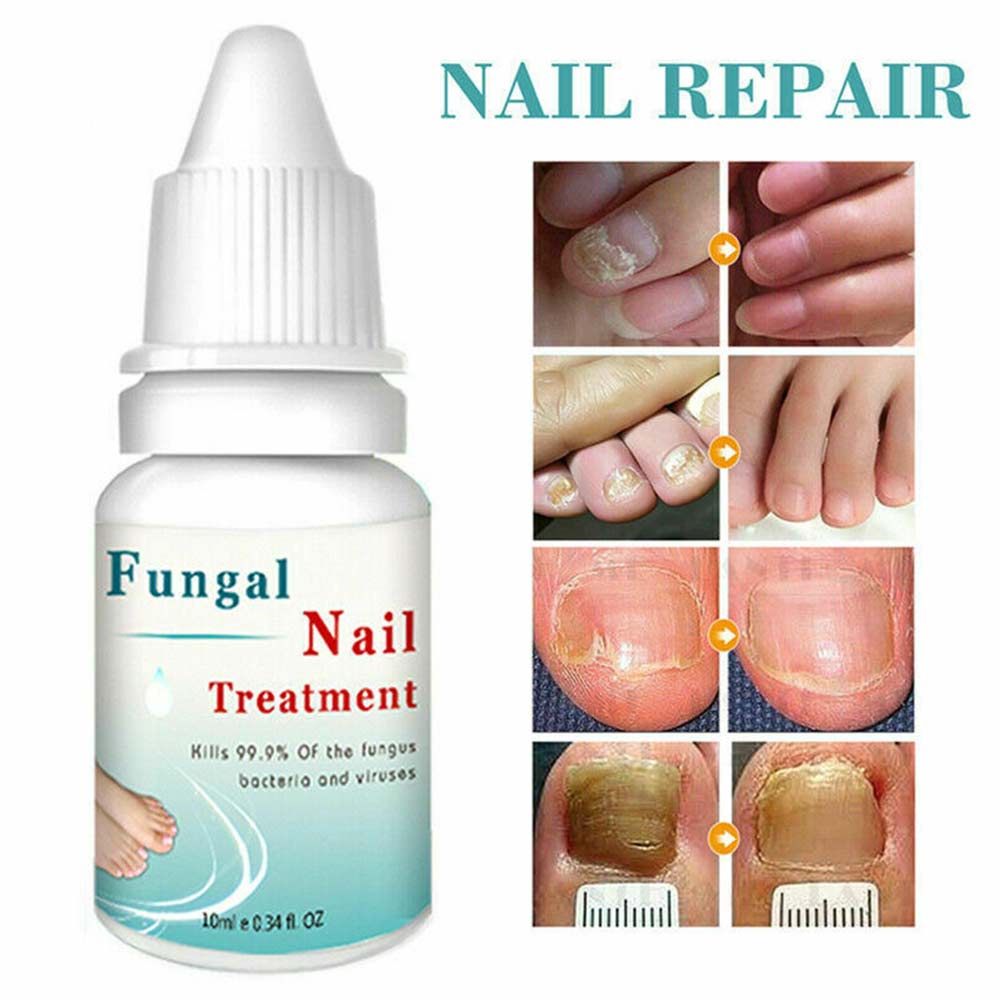 LANTHOME nail care repair solution for cracked, rough, discolored nails, separation 10ml