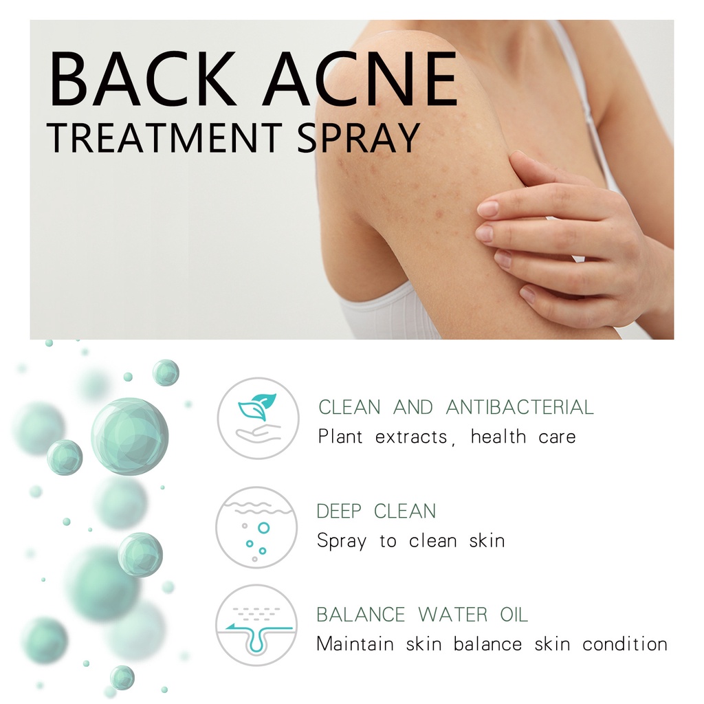 Jaysuing Keratosis Pilaris And Acne Repair Body Refreshing Cream 48g Anti Pimple Instant Curing