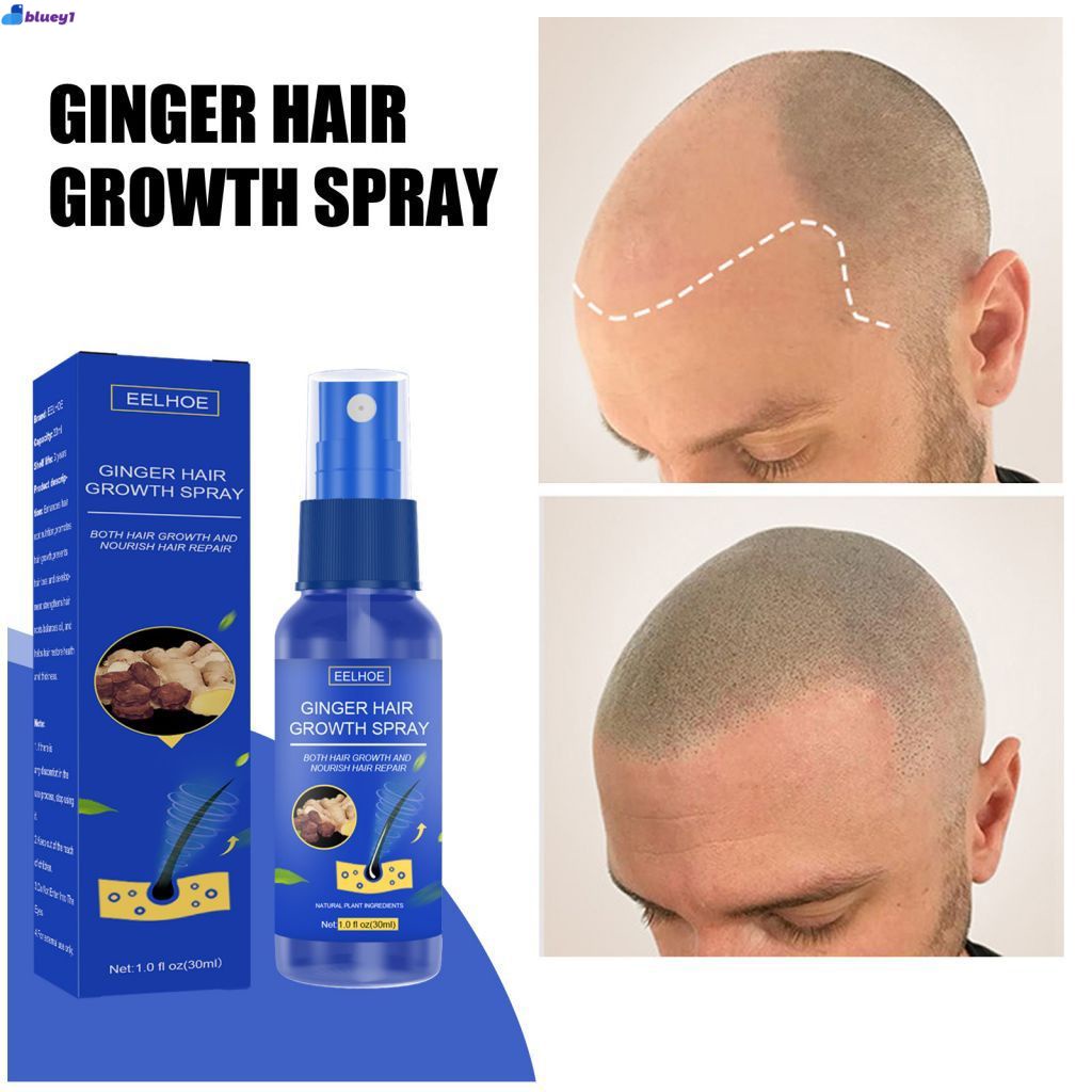eelhoe 30ml ginger hair spray hair growth care nutrient solution Ginger