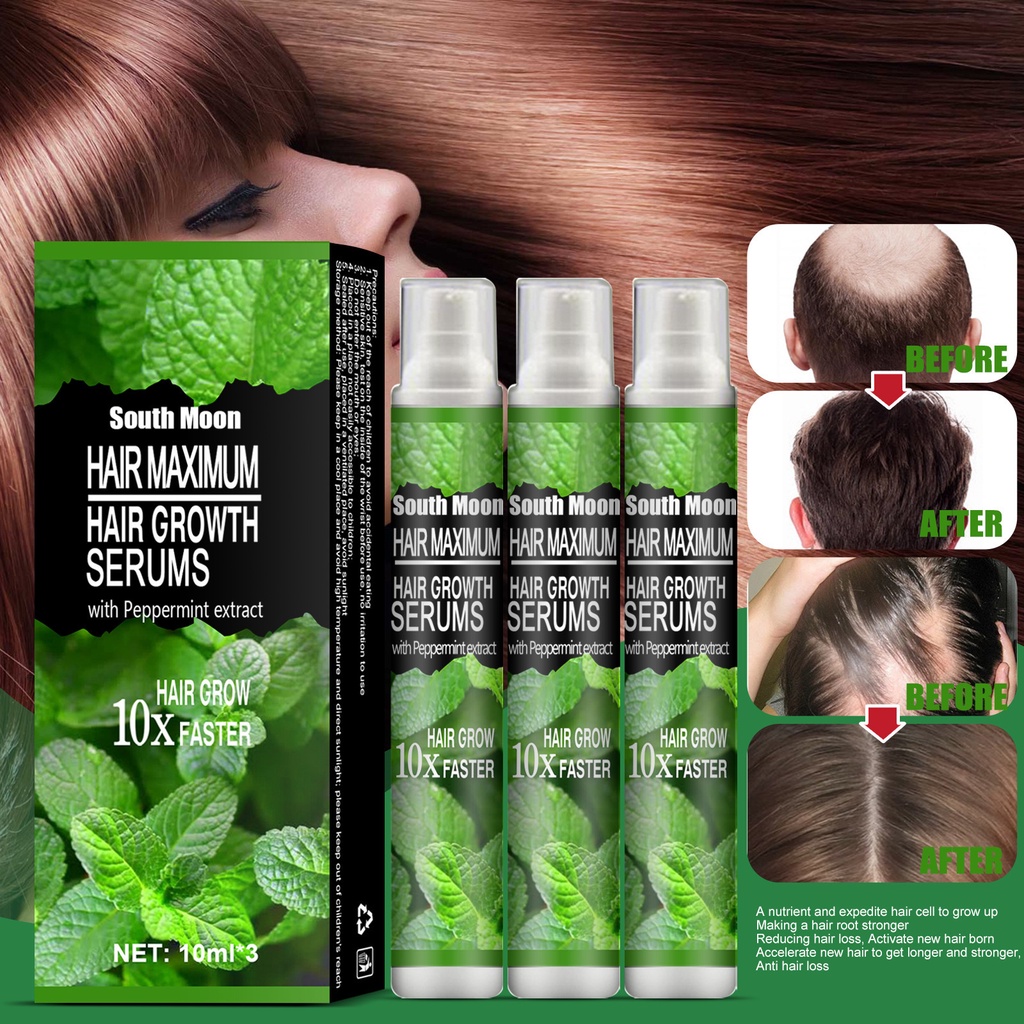 Hair Growth Spray Growth Liquid Solid Hair Nutrition Moisturizing Hair Follicle Black Hair 5745