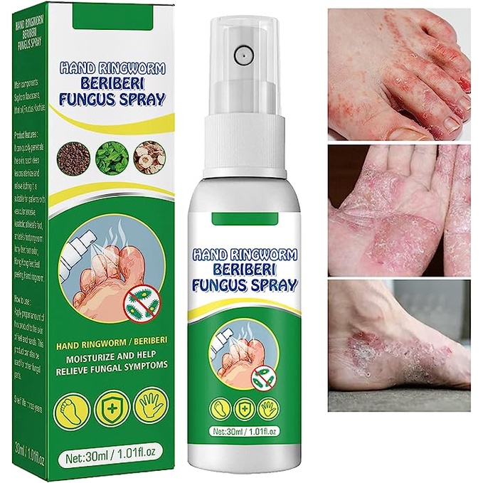 Athletes Foot Treatment Spray, Athletes Foot Treatment Extra Strength