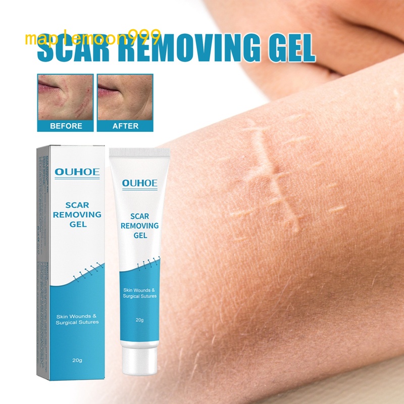 20g Scar Removal Cream Scar Repair Gel Fade Scars Burns Caesarean
