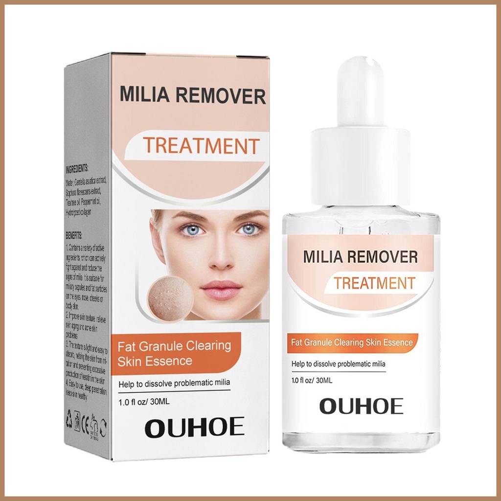 Milia Removal 30ml Gentle and Safe Milia Remover for Fat Granule