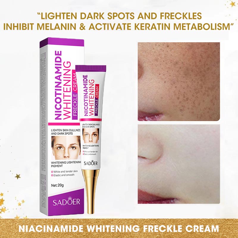 SADOER Niacinamide Whitening Freckle Cream Lightening Speckle Fade Dark Spots Pekas Cream