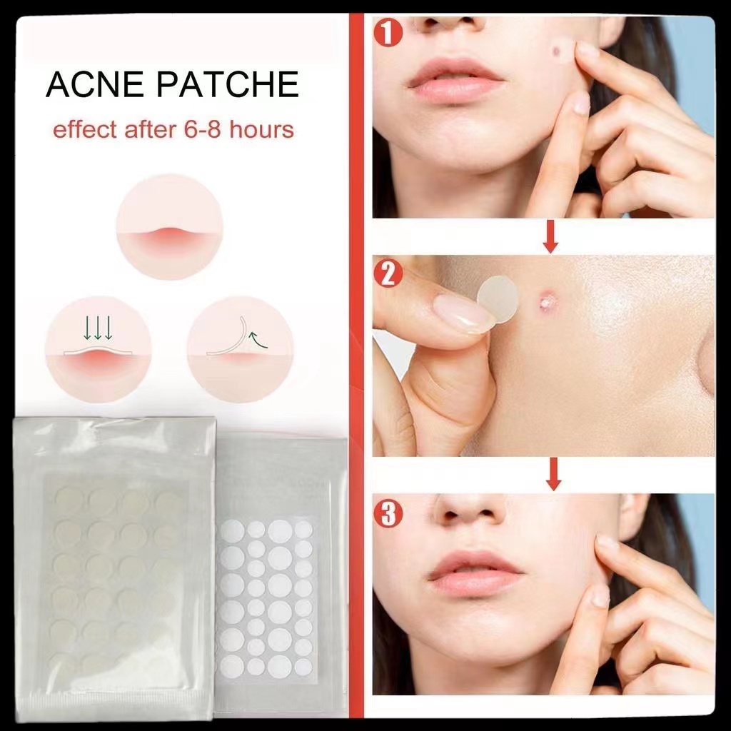 Acne Removal Invisible Facial Skin Care Breathable Stickers Blemish ...