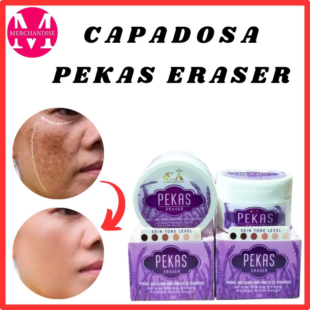 Pekas Melasma and Freckles Remover Eraser Cream by Capadosa Melasma and