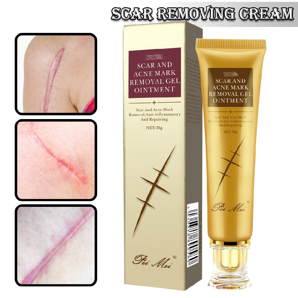 Scar Removal Cream 30g Pimple Scars Acne Mark Spots Remover Gel