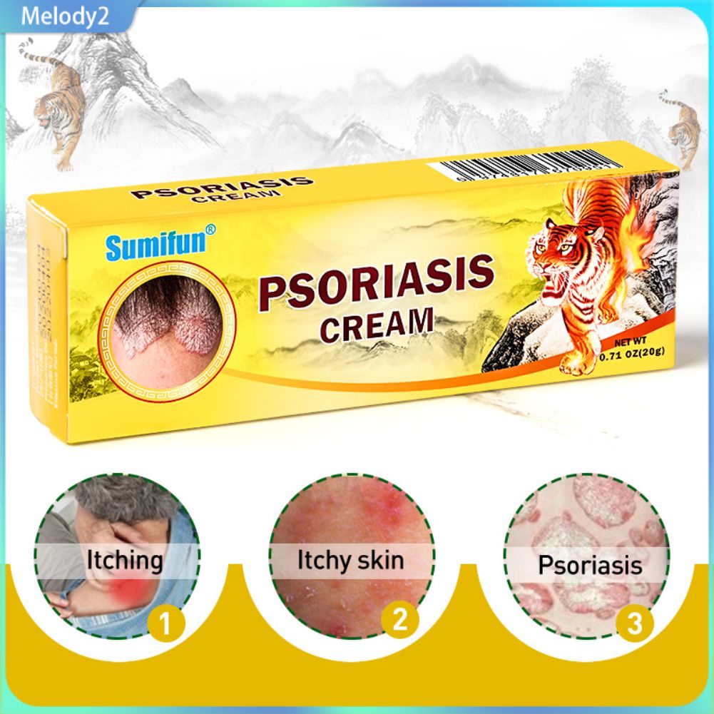 Sumifun 20g Psoriasis Ointment Skin Cream Dermatitis Eczema Tinea Itching Antipruritic Inhibit 5062