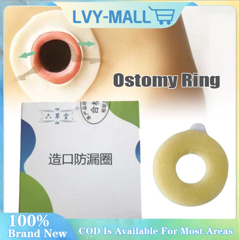 4mm Ostomy Paste Ring Ostomy Barrier Ring Stretch Shaping To Prevent