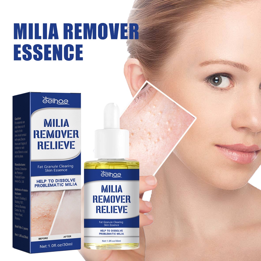 30ml Milia Remover Milia Spot Treatment For Eye Milia Treatment